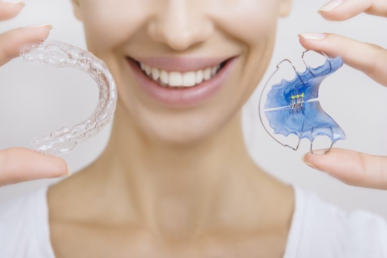 Retainers after braces – are they really needed?